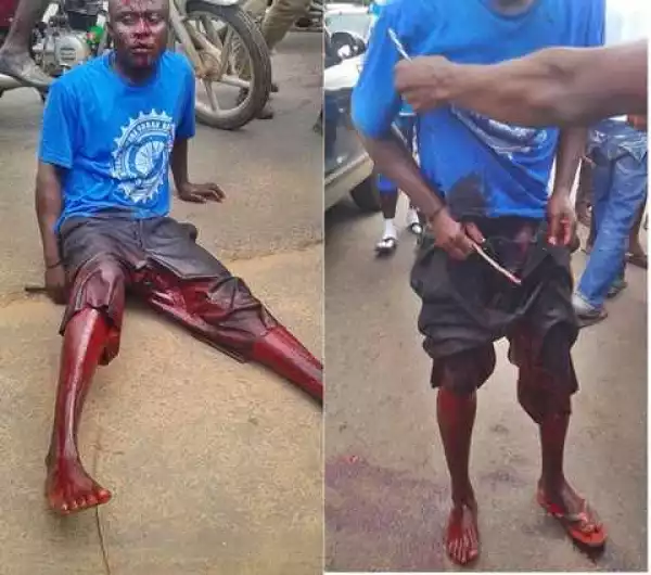 Too Bloody! Man in Excruciating Pain After His Manhood was Allegedly Cut-off in Broad Daylight (Photo)